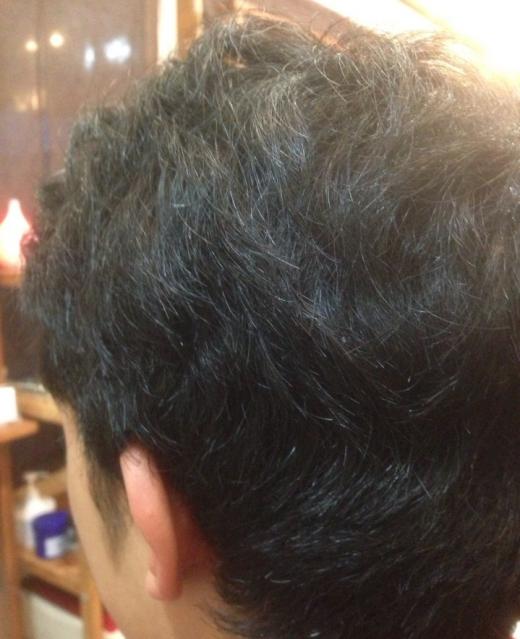 斜め後方から施術前です。/