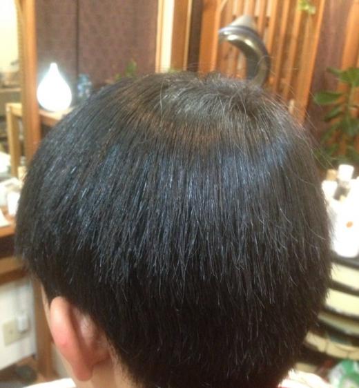 全体S矯正でした♪/