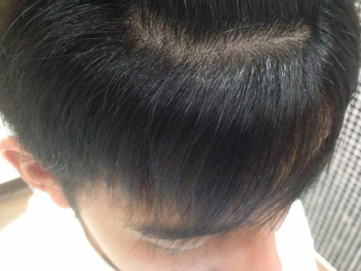 仕上がりです(アフター)/